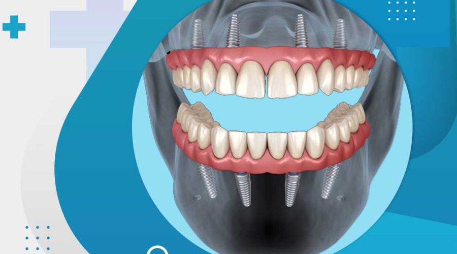 Marble Dental Centre Dentistry in Vaughan Woodbridge